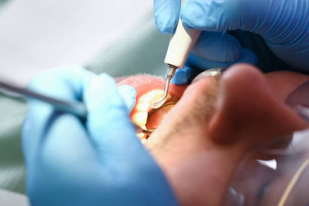 Best Chipped Tooth Repair Near Me  in West Brownsville, PA