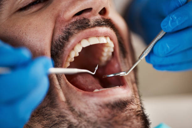 Best Tooth Infection Emergency Dentist  in West Brownsville, PA